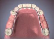 utilizar el mantenedor